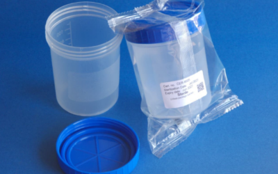 Selecting the Right Laboratory Containers for Sample Collection and Storage